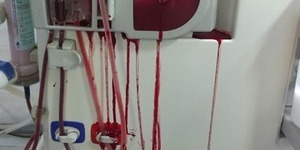 У лікарнях столиці розірвалися гемодіалізні системи