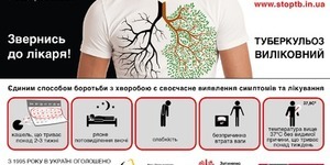 Для протидії туберкульозу при Київраді створять робочу групу