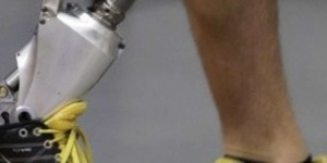 Киянам-учасникам АТО виділять кошти на протезування