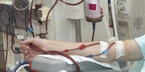 Департамент охорони здоров’я перевіряє якість витратних матеріалів для гемодіалізу