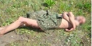 Столичні лікарі залишили вмирати бездомного під стінами моргу