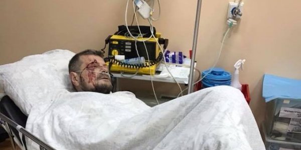 Вчора у вечорі в Києві стався потужний вибух біля входу до телеканалу «Еспрессо»