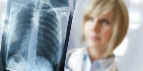 Кияни пройдуть флюорографічне обстеження на Хрещатику