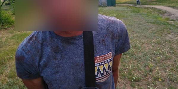 Патрульні Києва затримали грабіжника, що покусав перехожого