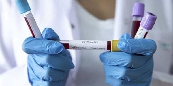 У Києві кількість заражених коронавірусом збільшилася на 57 людей