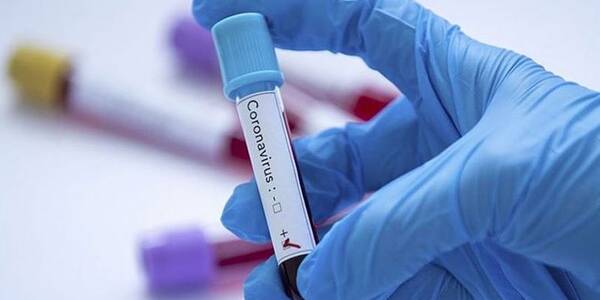 Ще 118 мешканців захворіли на коронавірус у столиці