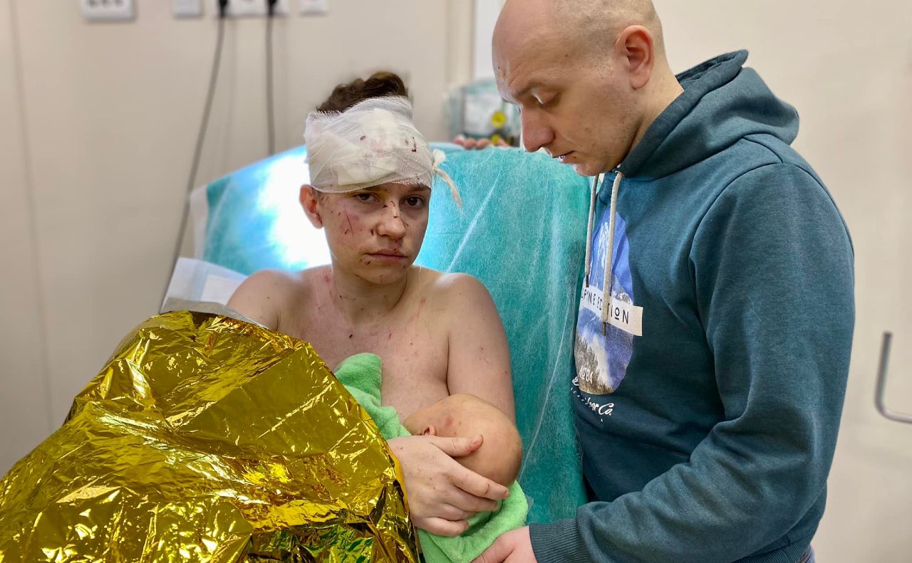 Мати Ольга прикрила своїм тілом немовля. Фото: Охматдит