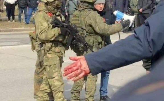 Люди у Славутичі в крові Фото: З відкритих джерел