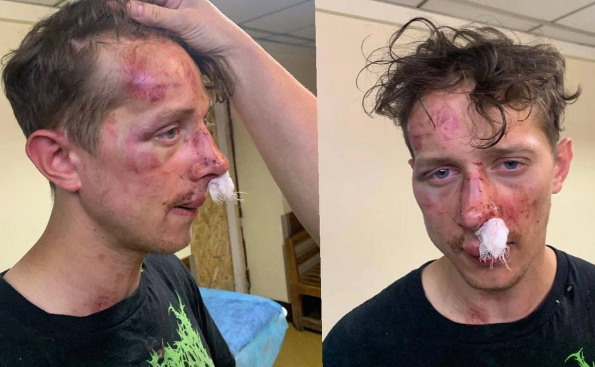 Фото надані сестрою потерпілого.