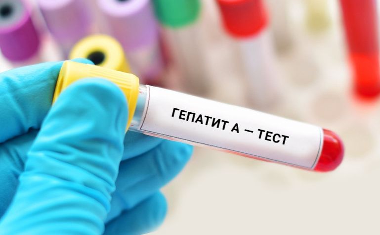 Охочі мають змогу пройти тестування. Ілюстративне фото з відкритих джерел