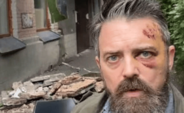 Постраждалий громадянин. Скріншот з відео ТСН