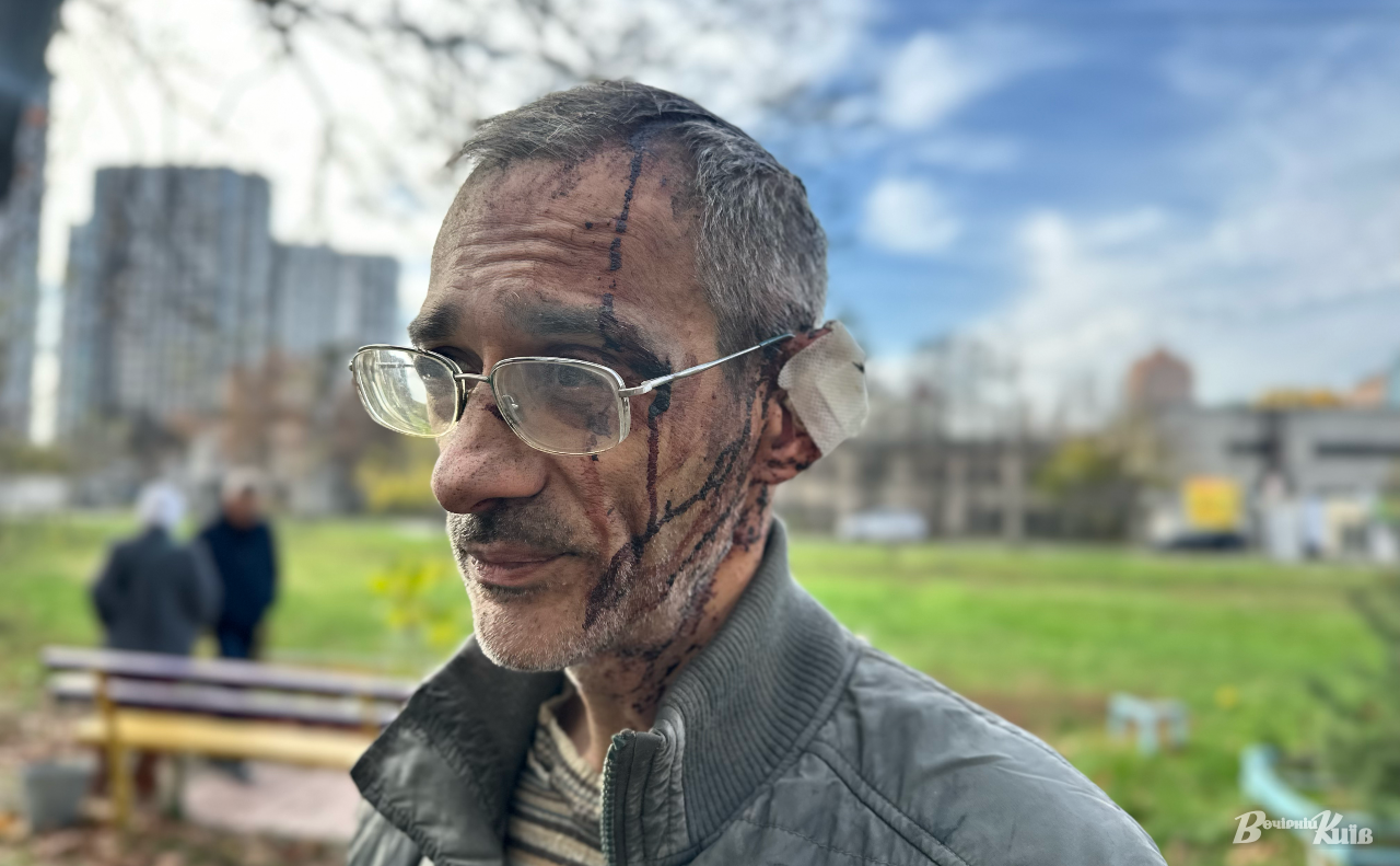 Постраждалий мешканець Дніпровського району Києва Аркадій у ніч на 14 листопада. Фото: Даша Гришина