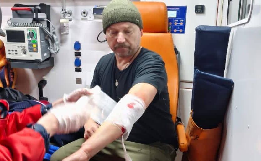 Журналісту надали допомогу медики. Фото: НСЖУ