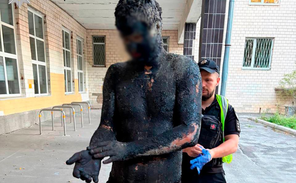Грабіжника-невдаху чистили олією та мийним засобом. Фото: Поліція Києва